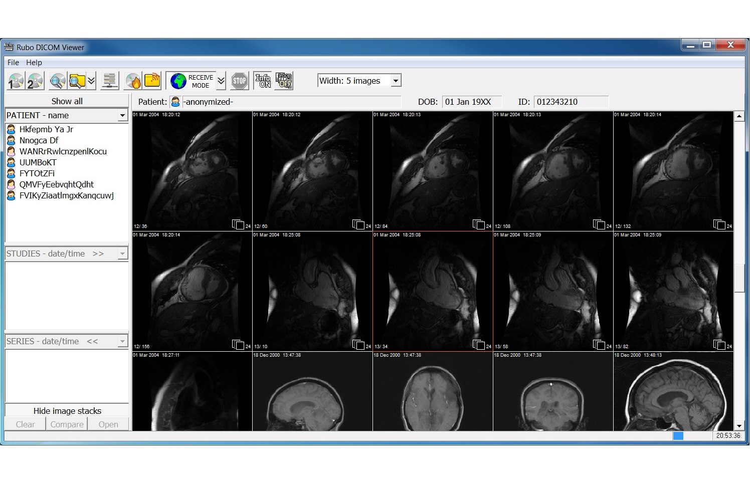 free dicom viewer with cd burning